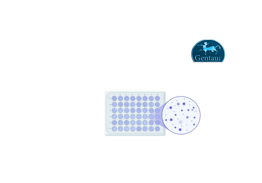 [KT-​1032] ELISA Kits  COVID-19 IgG 